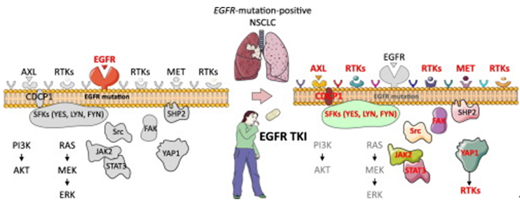 RTKs和non-RTKs的共激活共同导致了EGFR-TKI获得性耐药.jpg